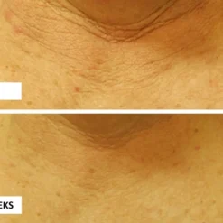 Perricone MD Cold Plasma Plus+ Neck & Chest -Promos Sublim Zen Magasin perricone md cold plasma plus neck chest creme raffermissante cou et decollete spf 25 3